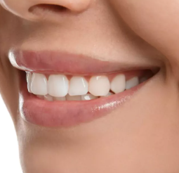 after smile